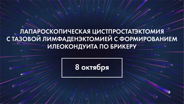 Bricker bo'yicha ileokonduitis hosil bo'lishi bilan tos limfadenektomiyasi bilan laparoskopik sistprostatektomiya